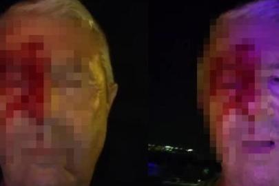 Haber yaparken saldırıya uğrayan muhabir yaralandı